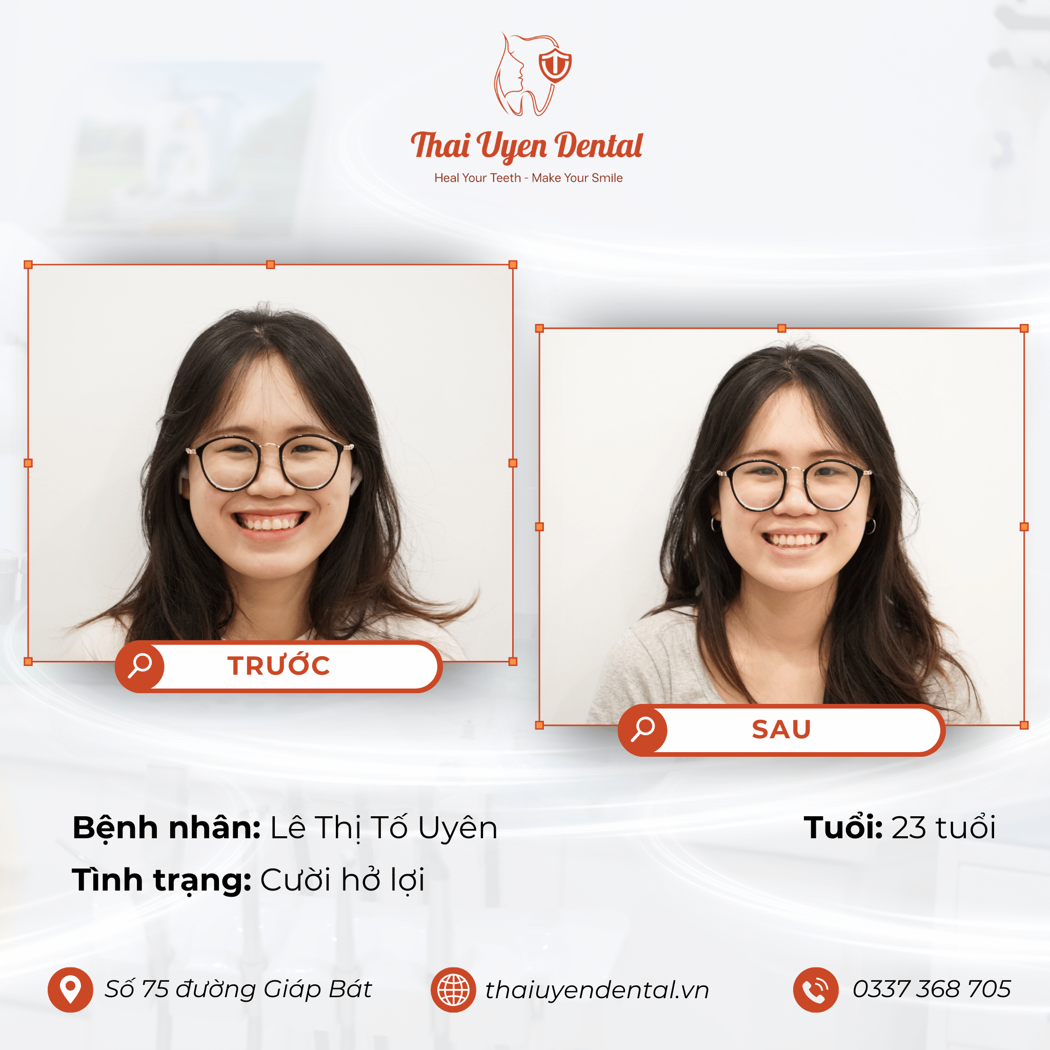 Bệnh nhân Lê Thị Tố Uyên tại Thai Uyen Dental (ảnh 1)