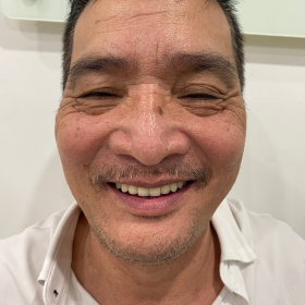 Cảm nhận của khách hàng Lê Tiến Lợi tại Thai Uyen Dental